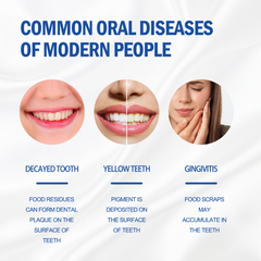 SP-4 mint toothpaste effectively manages oral health, deeply cleans dental stains and tartar for adults and children, prevents tooth decay, and freshens breath