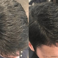 đ„Zeitlich begrenzt 50 % Rabattđ„Shampoo zum sofortigen FĂ€rben der Haare
