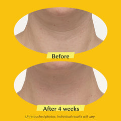 TL Advanced™ Straffende Halscreme PLUS mit Alpha-3 Peptide™ 