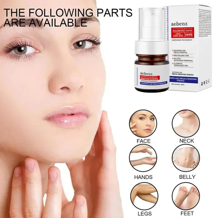 Niacinamide Serum Remove Dark Spots Melasma Chloasma Black Freckle Face Skin Care CreamWhitening Moisture Powerful Removal