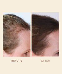GRO Hair Serum