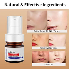 Niacinamide Serum Remove Dark Spots Melasma Chloasma Black Freckle Face Skin Care CreamWhitening Moisture Powerful Removal