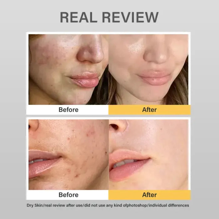 Deep Collagen Anti-Wrinkle Power Boosting Mask | The Original Overnight Collagen Mask Suitable for All Skin Types