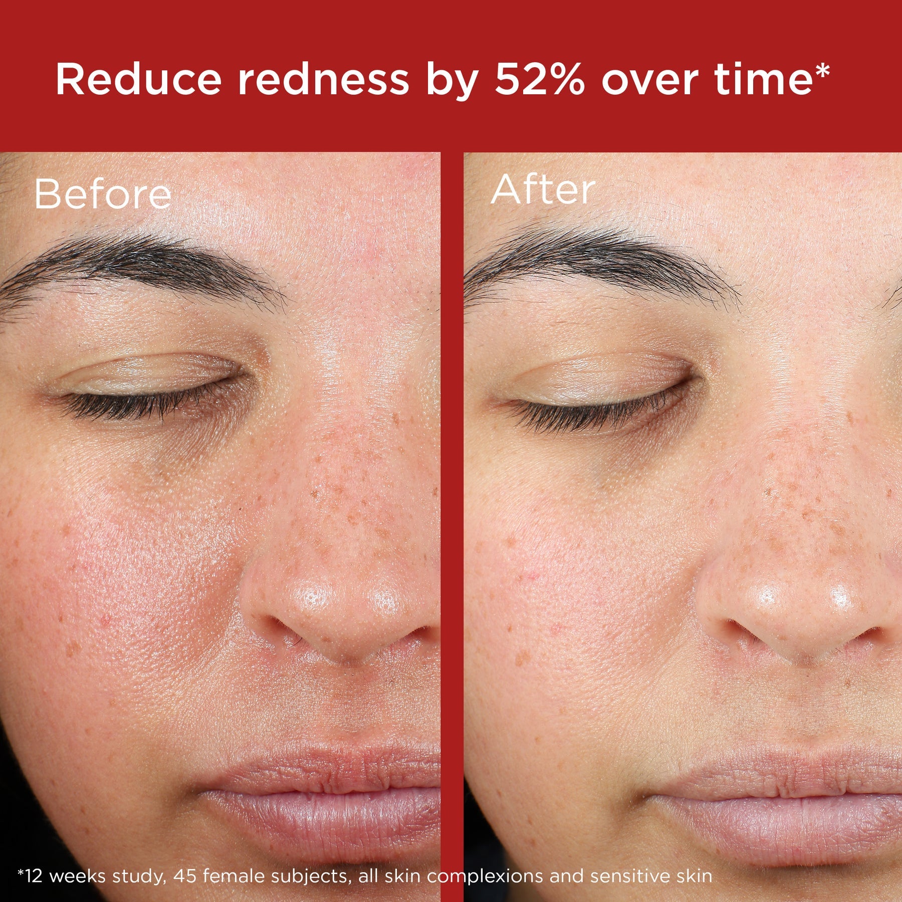 EltaMD UV Skin Recovery Red Color Correcting Green Tint Broad Spectrum SPF 50