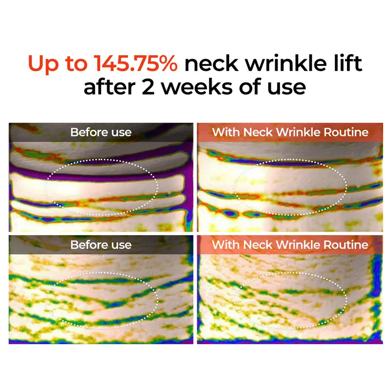 [Dr.Melaxin Official] Perfect Neck Wrinkle Care Set｜Necksphalt+Necklinphalt | Korean Cosmetics
