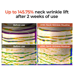 [Dr.Melaxin Official] Perfect Neck Wrinkle Care Set｜Necksphalt+Necklinphalt | Korean Cosmetics