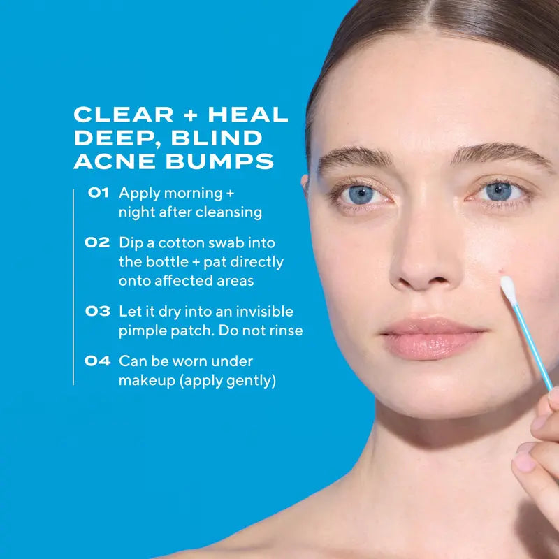 Deep Relief Acne Treatment [ Exclusive 2 Pack]