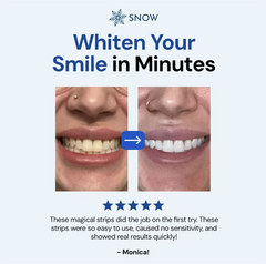 Diamond Dissolving Whitening Strips